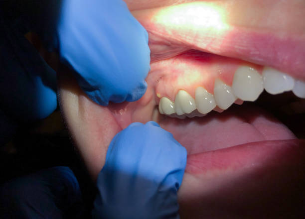 Best Emergency Dental Surgery in Ellsworth, KS